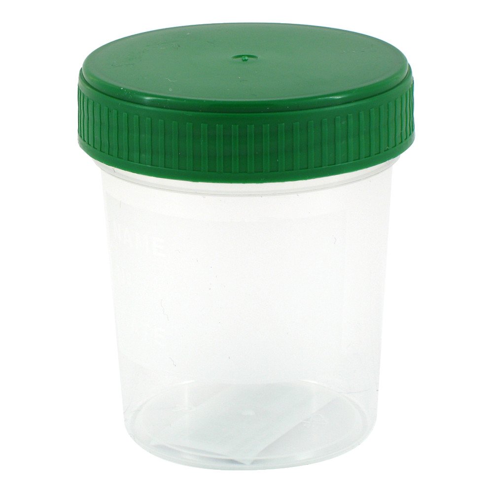 Urinbecher 120 Ml Gradu.Beschr.M.Schraubdeckel (1 stk)